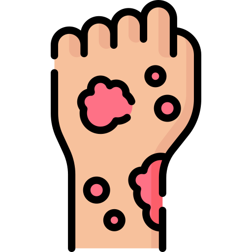 Skin Disease